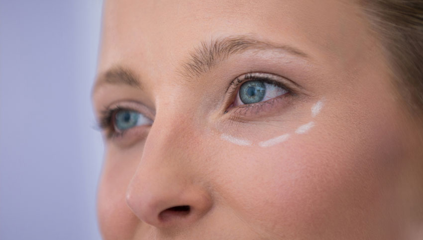 Todo lo que debes saber de la blefaroplastia inferior