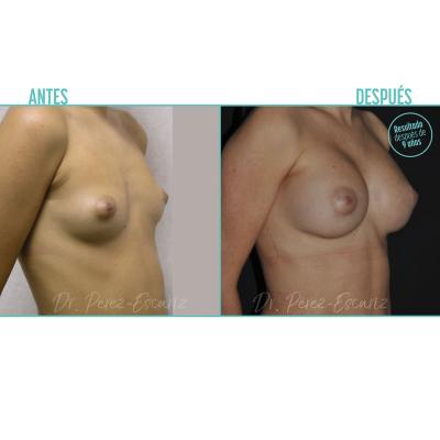 Escariz 111104 9aos Casoreal Mama Web2025 1